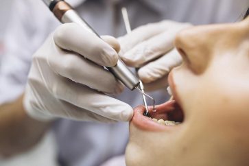_0001_Periodontia