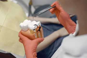 _0007_Endodontia